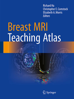 Comstock, Christopher E. - Breast MRI Teaching Atlas, ebook