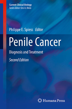 Spiess, Philippe E. - Penile Cancer, ebook