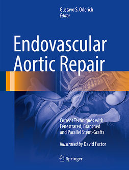 Oderich, Gustavo S. - Endovascular Aortic Repair, ebook