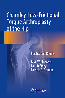 Fleming, Patricia A. - Charnley Low-Frictional Torque Arthroplasty of the Hip, e-bok