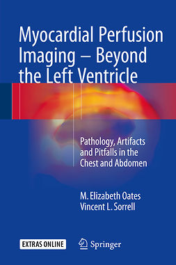 Oates, M. Elizabeth - Myocardial Perfusion Imaging - Beyond the Left Ventricle, e-bok