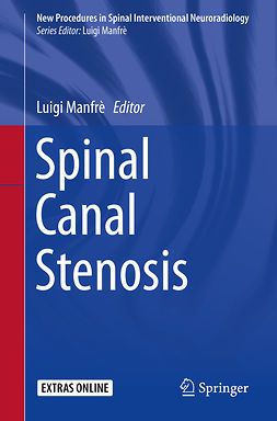 Manfrè, Luigi - Spinal Canal Stenosis, e-kirja