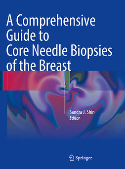 Shin, Sandra J. - A Comprehensive Guide to Core Needle Biopsies of the Breast, e-kirja