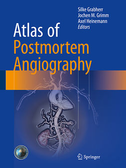 Grabherr, Silke - Atlas of Postmortem Angiography, ebook