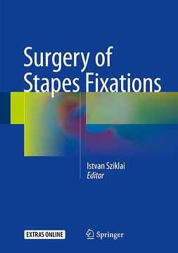 Sziklai, Istvan - Surgery of Stapes Fixations, ebook