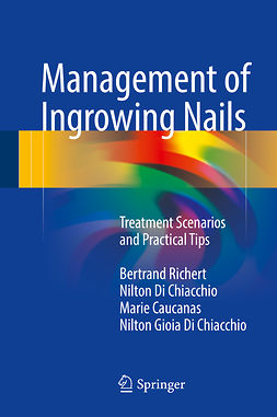 Caucanas, Marie - Management of Ingrowing Nails, ebook