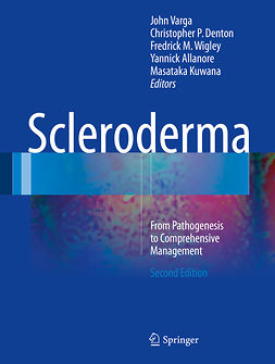 Allanore, Yannick - Scleroderma, ebook