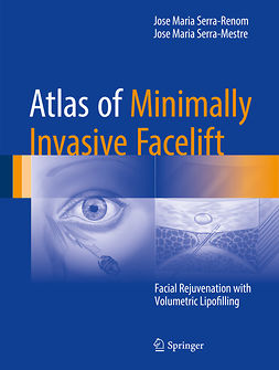 Serra-Mestre, Jose Maria - Atlas of Minimally Invasive Facelift, e-bok