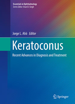 Alió, Jorge L. - Keratoconus, ebook