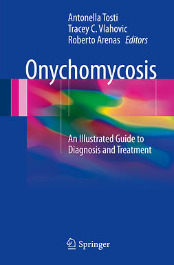 Arenas, Roberto - Onychomycosis, ebook