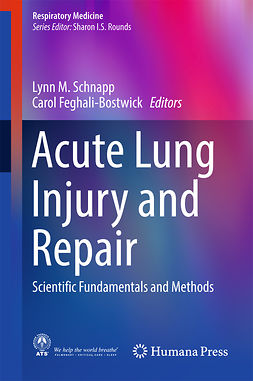 Feghali-Bostwick, Carol - Acute Lung Injury and Repair, e-bok