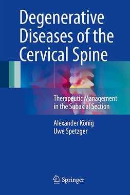König, Alexander - Degenerative Diseases of the Cervical Spine, ebook