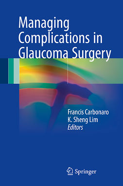 Carbonaro, Francis - Managing Complications in Glaucoma Surgery, e-kirja