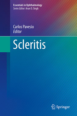 Pavesio, Carlos - Scleritis, ebook