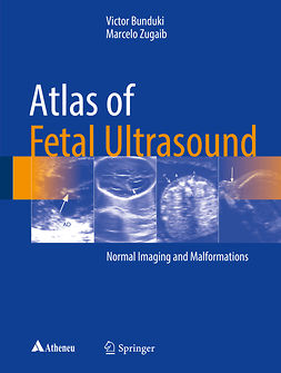 Bunduki, Victor - Atlas of Fetal Ultrasound, e-kirja