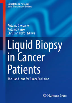 Giordano, Antonio - Liquid Biopsy in Cancer Patients, e-bok