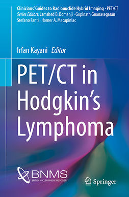 Kayani, Irfan - PET/CT in Hodgkin’s Lymphoma, ebook