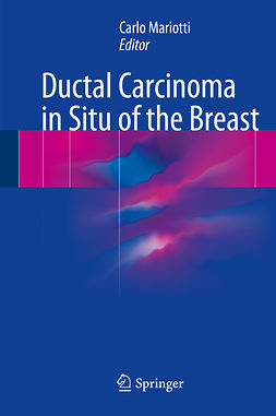 Mariotti, Carlo - Ductal Carcinoma in Situ of the Breast, ebook