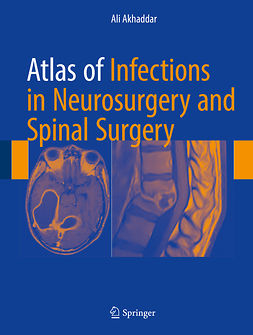 Akhaddar, Ali - Atlas of Infections in Neurosurgery and Spinal Surgery, ebook
