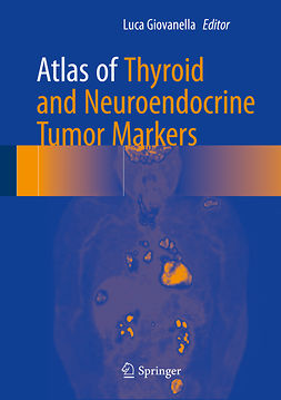 Giovanella, Luca - Atlas of Thyroid and Neuroendocrine Tumor Markers, ebook