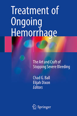 Ball, Chad G. - Treatment of Ongoing Hemorrhage, ebook