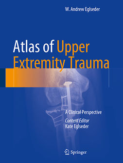 Eglseder, W. Andrew - Atlas of Upper Extremity Trauma, e-bok