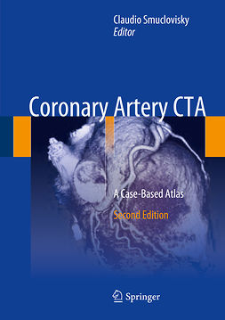 Smuclovisky, Claudio - Coronary Artery CTA, e-kirja