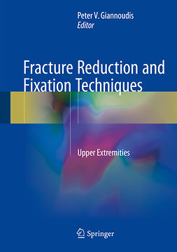 Giannoudis, Peter V. - Fracture Reduction and Fixation Techniques, e-bok