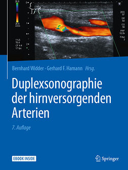 Hamann, Gerhard F. - Duplexsonographie der hirnversorgenden Arterien, ebook