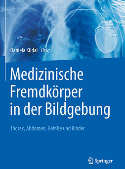 Kildal, Daniela - Medizinische Fremdkörper in der Bildgebung, ebook