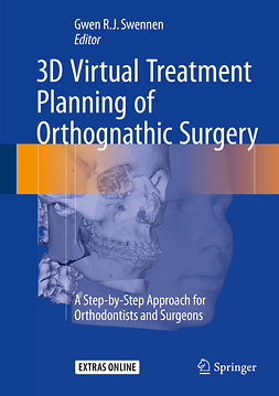 Swennen, Gwen - 3D Virtual Treatment Planning of Orthognathic Surgery, e-kirja