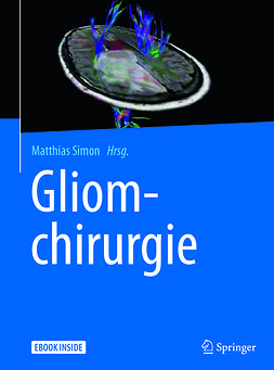 Simon, Matthias - Gliomchirurgie, ebook