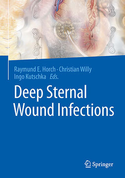 Horch, Raymund E. - Deep Sternal Wound Infections, ebook