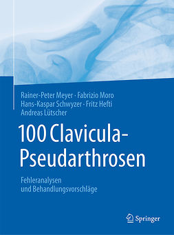 Hefti, Fritz - 100 Clavicula-Pseudarthrosen, e-bok