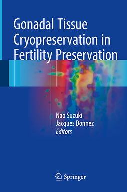 Donnez, Jacques - Gonadal Tissue Cryopreservation in Fertility Preservation, e-kirja