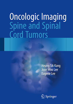 Kang, Heung Sik - Oncologic Imaging: Spine and Spinal Cord Tumors, e-bok