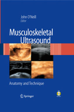 O’Neill, John M.D. - Musculoskeletal Ultrasound, ebook