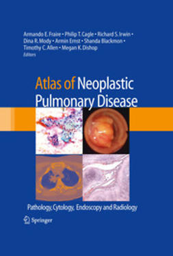 Fraire, Armando E. - Atlas of Neoplastic Pulmonary Disease, ebook