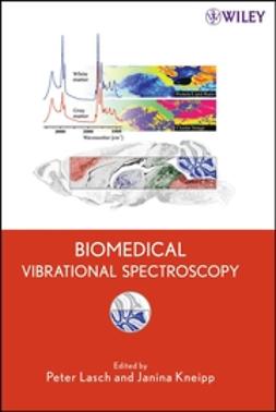 Lasch, Peter - Biomedical Vibrational Spectroscopy, ebook