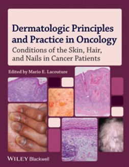 Lacouture, Mario E. - Dermatologic Principles and Practice in Oncology: Conditions of the Skin, Hair, and Nails in Cancer Patients, e-kirja