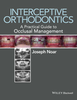 Noar, Joseph - Interceptive Orthodontics: A Practical Guide to Occlusal Management, ebook