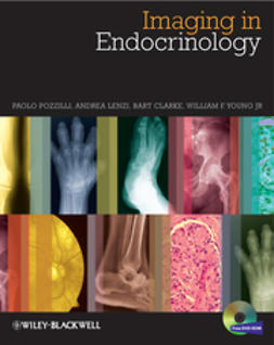 Clarke, Bart L. - Imaging in Endocrinology, e-bok