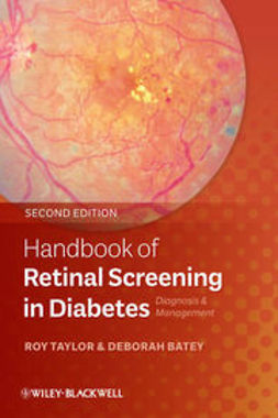 Taylor, Roy - Handbook of Retinal Screening in Diabetes: Diagnosis and Management, e-bok