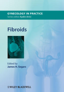 Segars, James H. - Fibroids, e-kirja