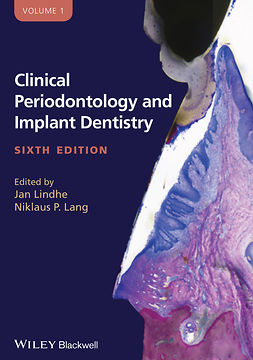 Lang, Niklaus P. - Clinical Periodontology and Implant Dentistry, 2 Volume Set, e-bok