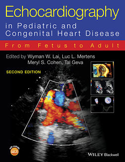 Cohen, Meryl S. - Echocardiography in Pediatric and Congenital Heart Disease: From Fetus to Adult, e-bok