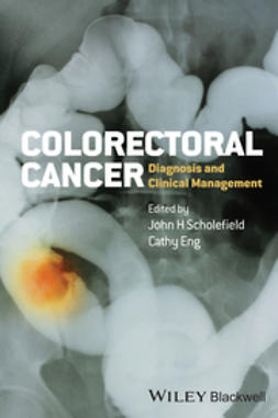 Scholefield, John - Colorectal Cancer: Diagnosis and Clinical Management, ebook