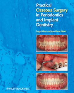Dibart, Serge - Practical Osseous Surgery in Periodontics and Implant Dentistry, ebook