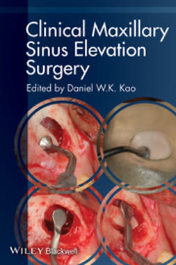 Kao, Daniel W. K. - Clinical Maxillary Sinus Elevation Surgery, e-kirja