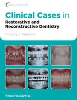 DDS, Gregory J. Tarantola, - Clinical Cases in Restorative and Reconstructive Dentistry, e-kirja
